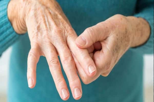 Inflamación en las articulaciones de los dedos