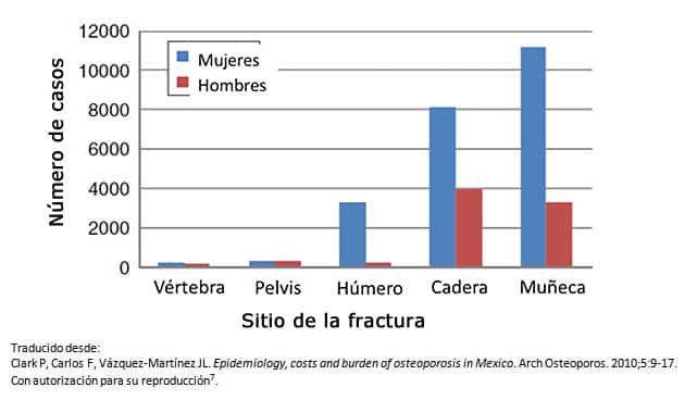 Grafico Tipos de Fracturas ocurridos en México