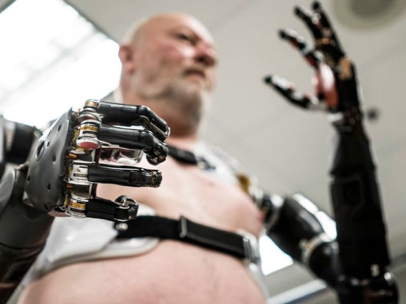 IA aplicada a prótesis
